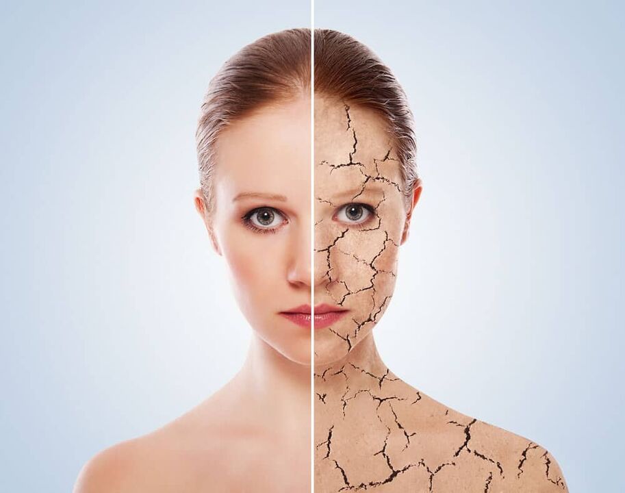 Gesond Haut a psoriasis betraff Haut