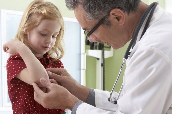 Psoriasis an engem fréien Alter